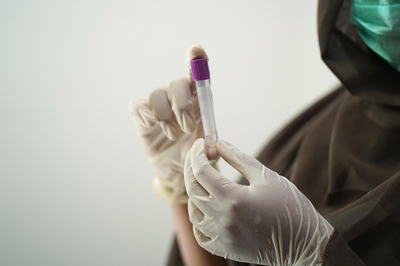 HIV test